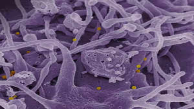 Crimean-Congo Hemorrhagic Fever