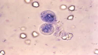 Entamoeba moshkovskii