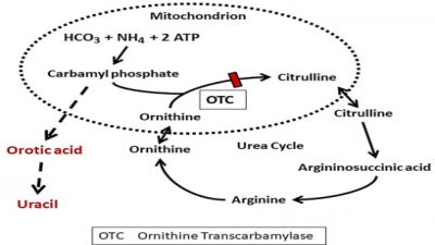 Ornithine Transcarbamylase Deficiency