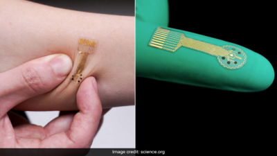 Smart Bandages