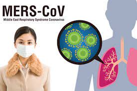 Middle East Respiratory Syndrome (MERS)