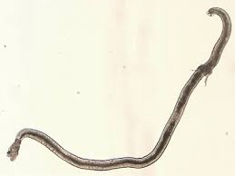 Angiostrongylus Cantonensis