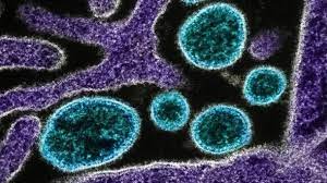 Nipah Virus