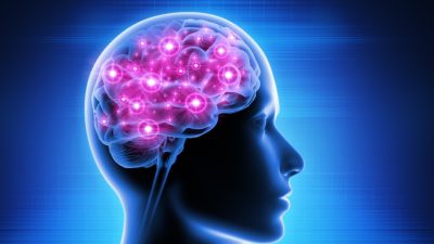 Functional Neurological Disorder