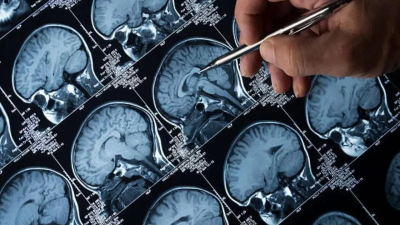 IIT Madras Advances Fetal Brain Imaging Technology