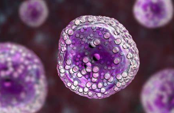 Lymphoma – Symptoms, Risk Factors, and Treatment Options