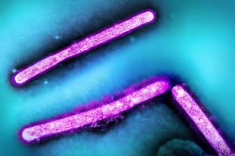 New Avian Flu Strain Raises Health Concerns