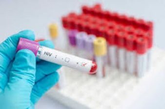 Cardiovascular Risk Models for People with HIV
