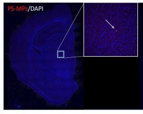 Microplastics and Their Impact on Brain Function