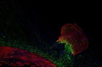 Zebrafish Heart Regeneration – Role of Hmga1 Protein
