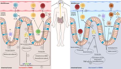 Gut Microbiome’s Role in Multiple Sclerosis Severity