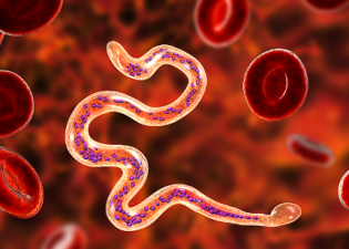 Global Efforts to Eliminate Filariasis by 2030