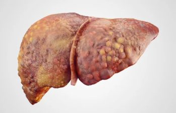 Antibiotic-Induced Liver Toxicity and Membrane Interaction