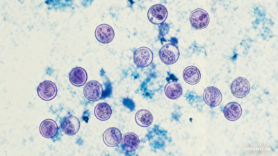 Key Facts About Cyclospora Parasite